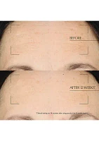 Advanced Night Repair Moisturizing Overnight Treatment with Hyaluronic Acid