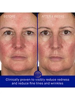 The Hydrogel Face Mask
