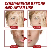 KojicLux Kojic Acid Facial Cream (50g)