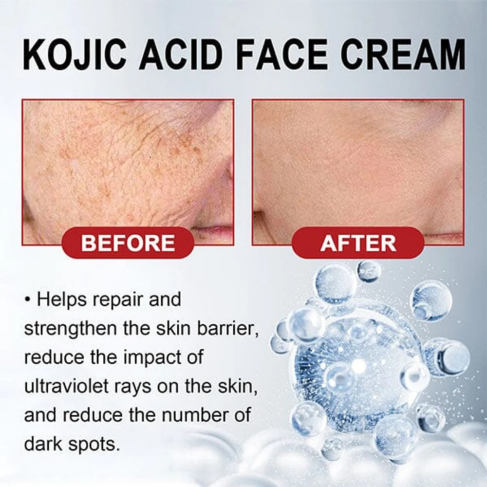 KojicLux Kojic Acid Facial Cream (50g)