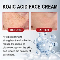 KojicLux Kojic Acid Facial Cream (50g)