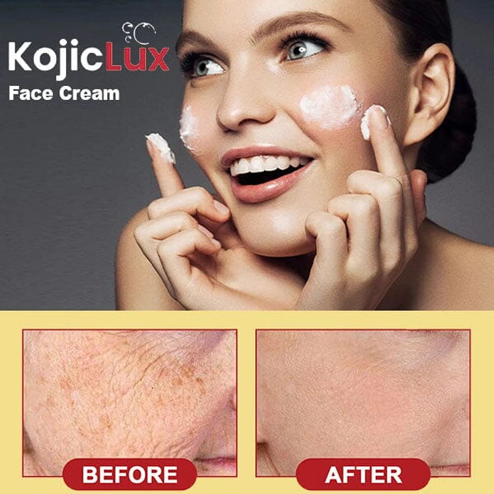 KojicLux Kojic Acid Facial Cream (50g)