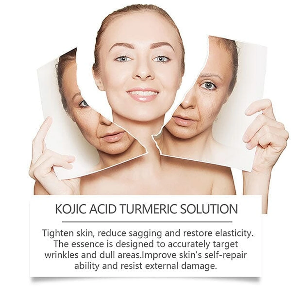 KojicLux Kojic Acid & Turmeric Root Facial Serum (30mL)