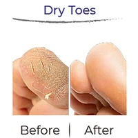 RevivaFoot Exfoliating Foot Peel Masks (2pk) | As Seen On Social!