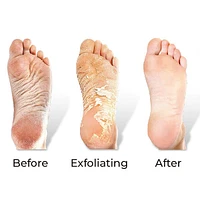 RevivaFoot Exfoliating Foot Peel Masks (2pk) | As Seen On Social!