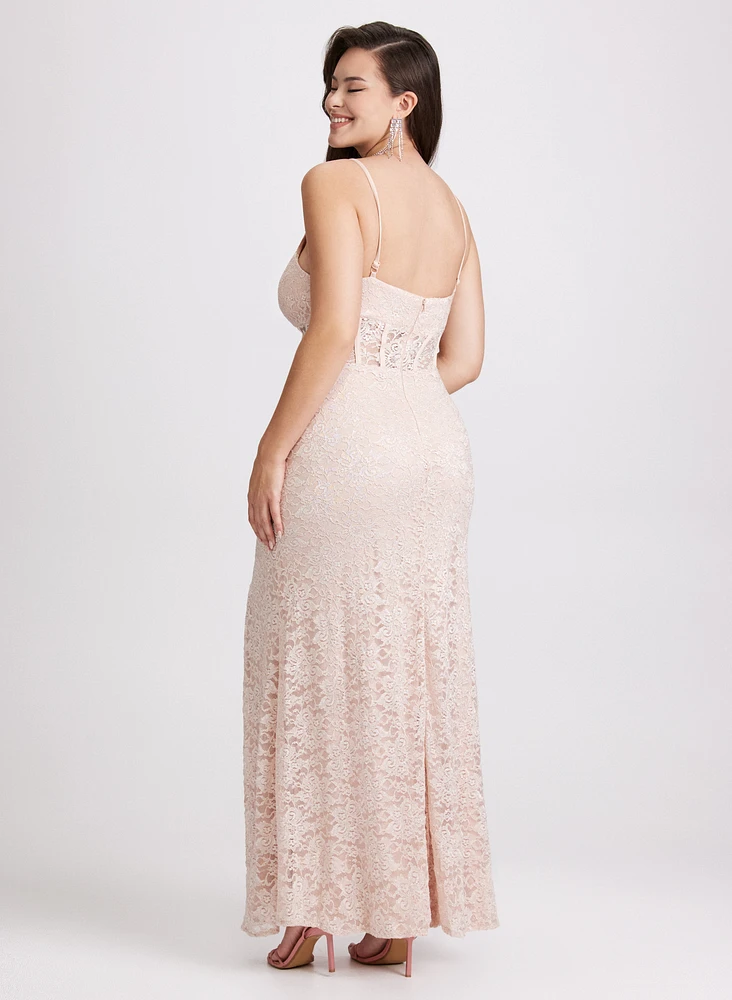 Scalloped Lace Dress