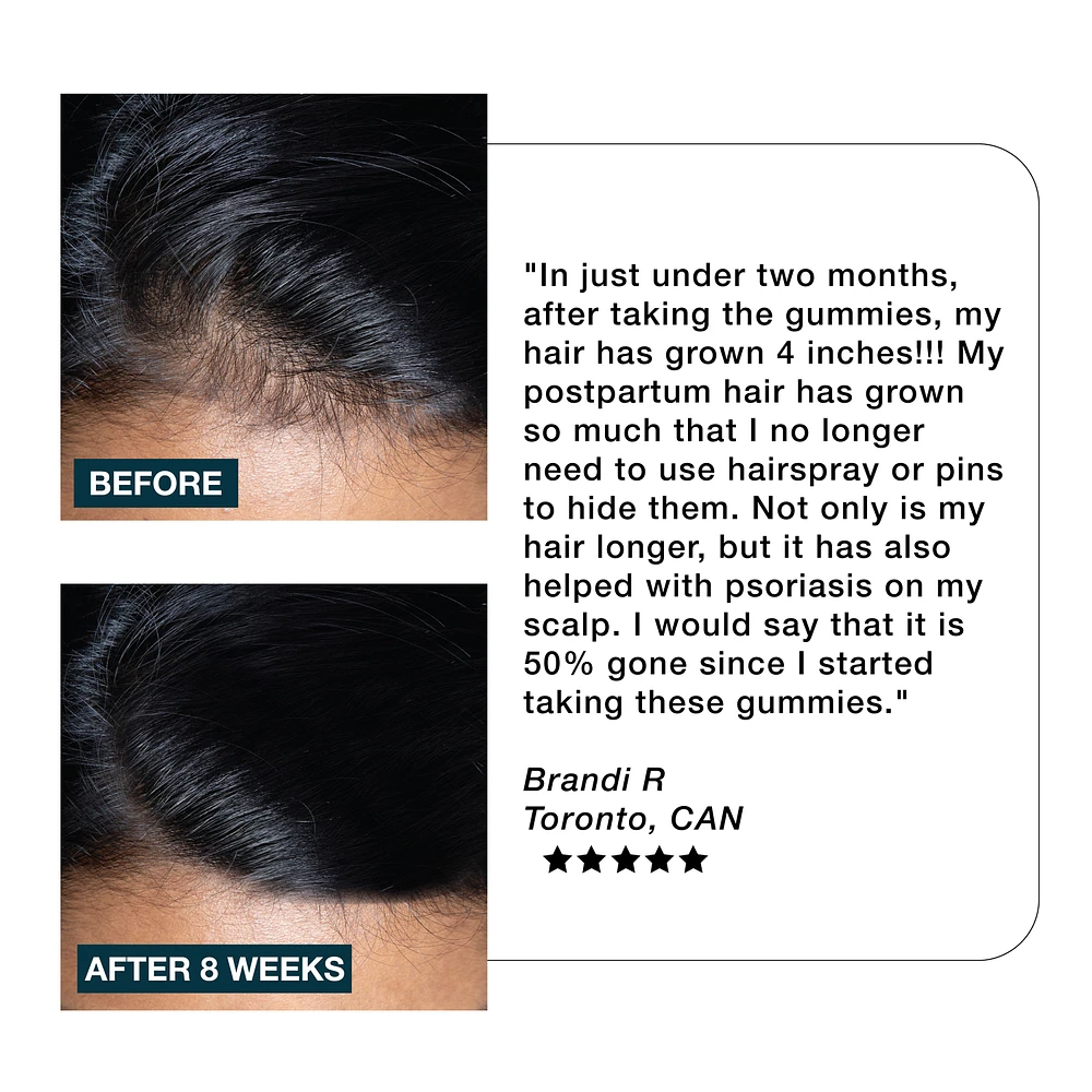 IMARAIS BEAUTY Nourish Haircare Gummies