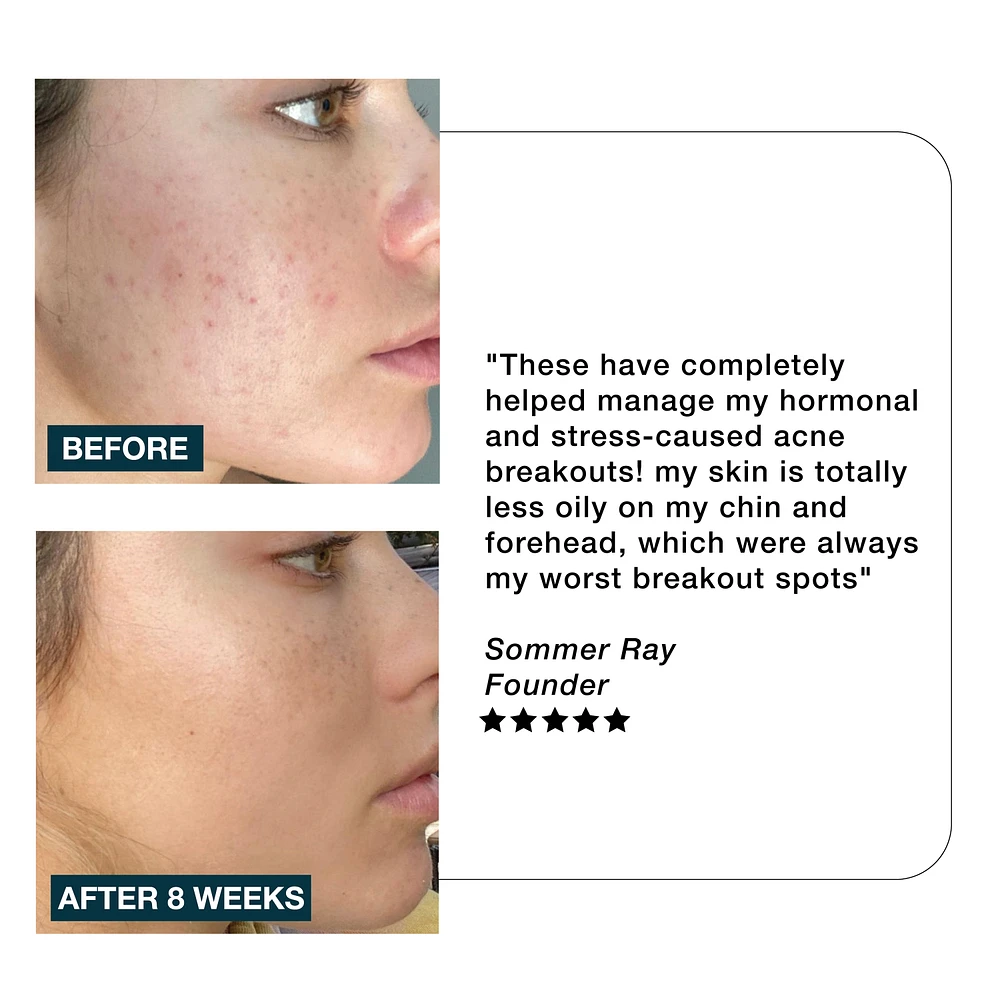 IMARAIS BEAUTY Clarity Anti-Acne Gummies