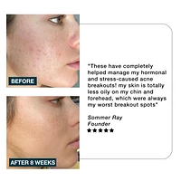 IMARAIS BEAUTY Clarity Anti-Acne Gummies