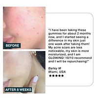 IMARAIS BEAUTY Glow Skincare Gummies