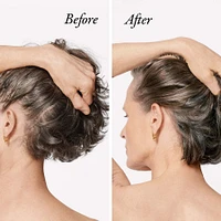 Serene Scalp Densifying Treatement Spray