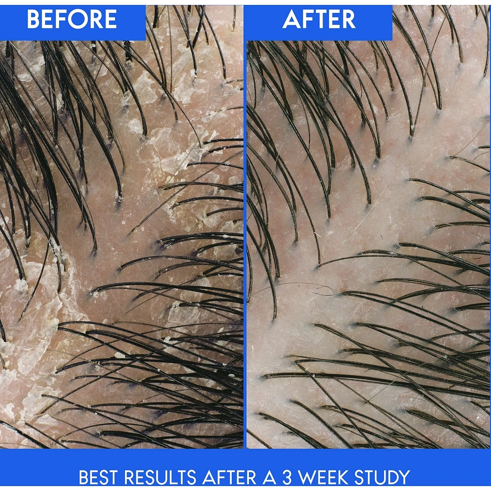 Shampooing et revitalisant antipelliculaire 2∘en∘1 Head & Shoulders Soin du cuir chevelu sec