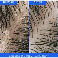Shampooing et revitalisant antipelliculaire 2∘en∘1 Head & Shoulders Soin du cuir chevelu sec