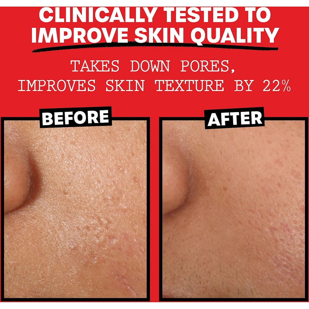 Original Alcohol-Free Witch Hazel Face Toner with Aloe Vera