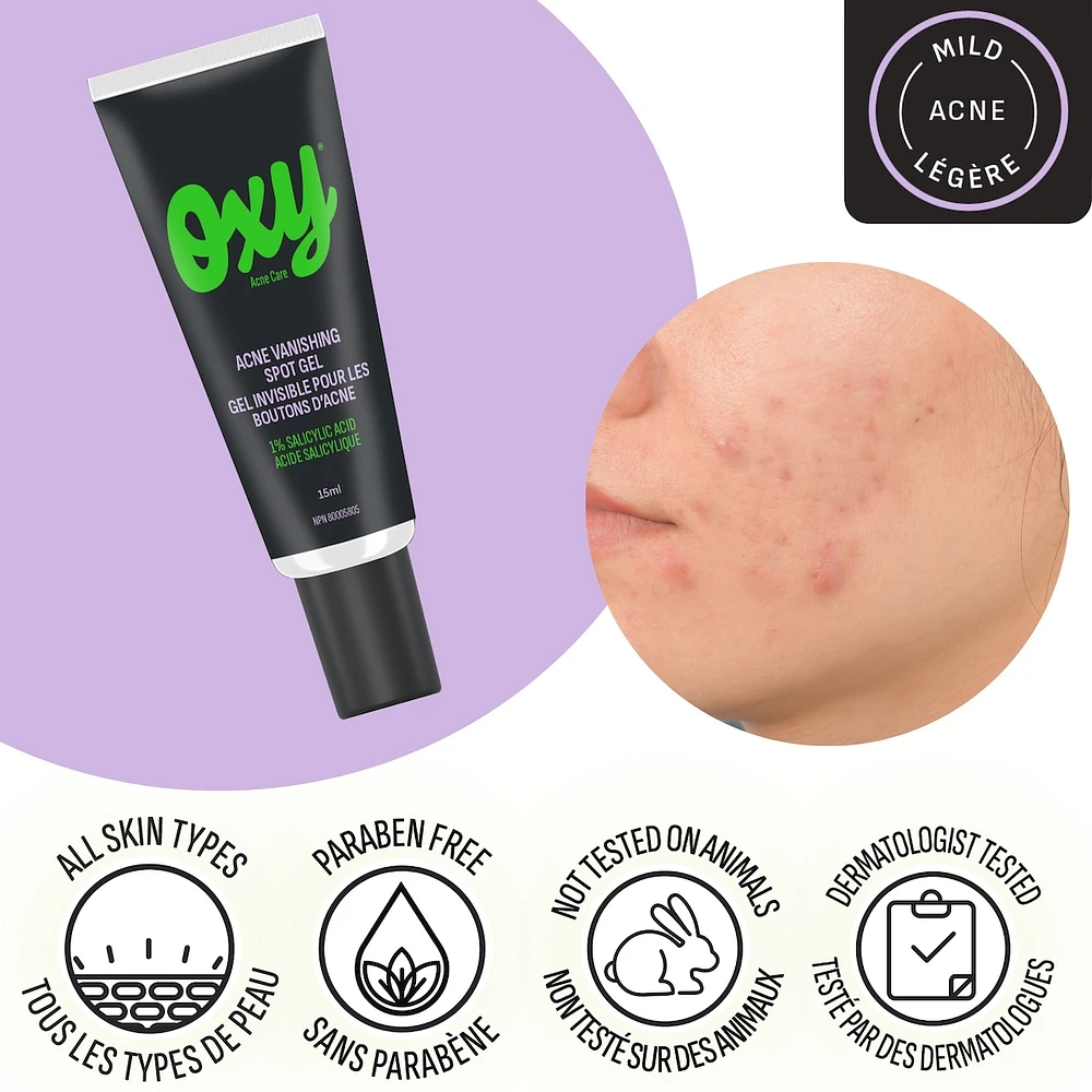 Emergency Acne Vanishing Spot Gel Treatment with Salicylic Acid, For Inflamed Acne