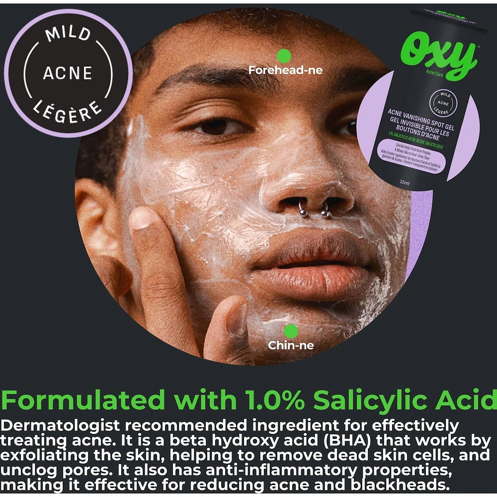 Emergency Acne Vanishing Spot Gel Treatment with Salicylic Acid, For Inflamed Acne