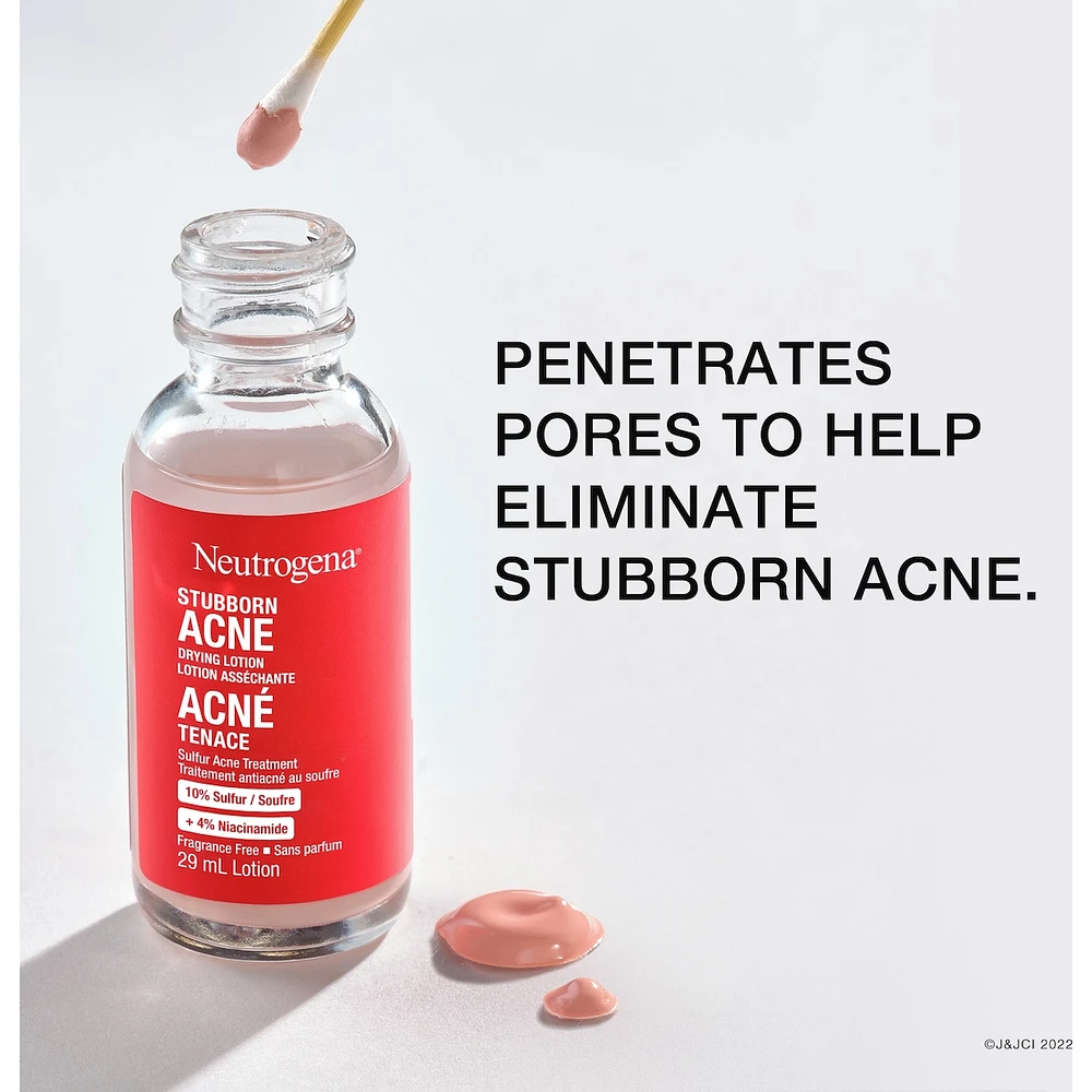 Stubborn Acne Drying Lotion