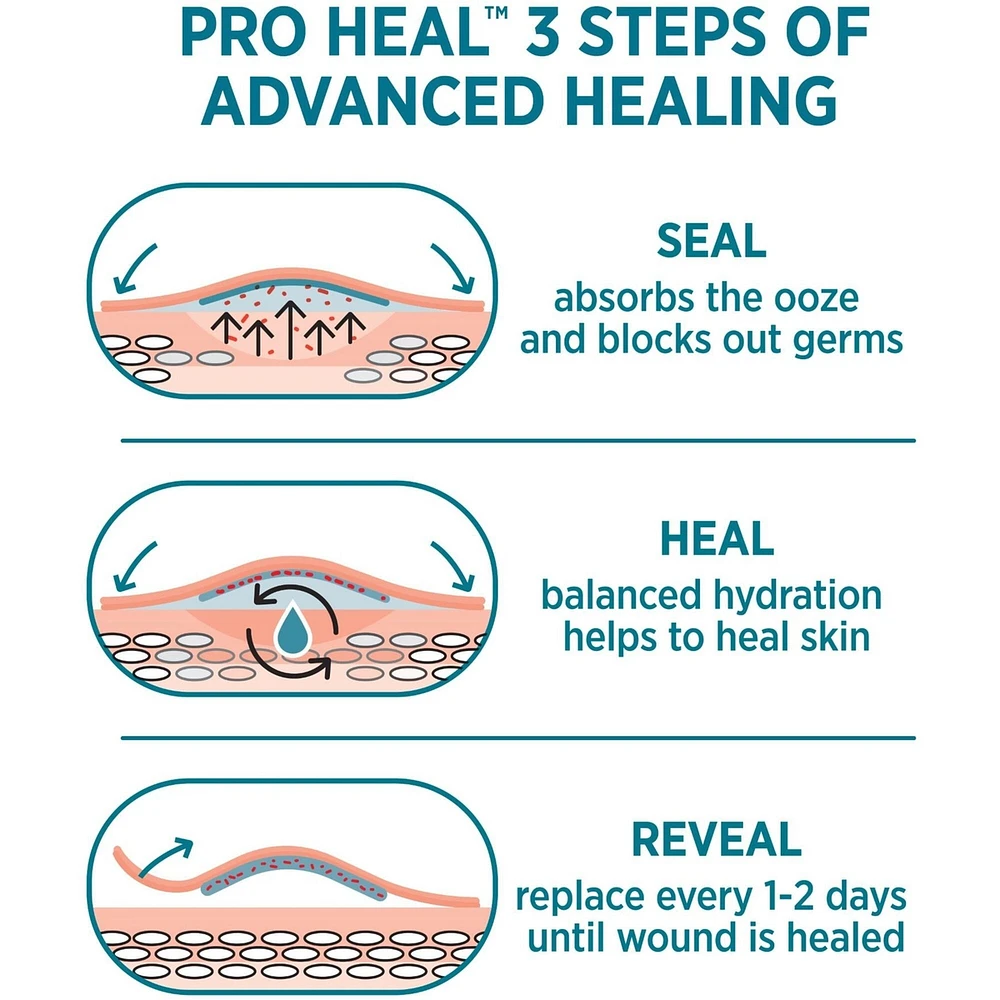 Pro Heal Adhesive Bandages, All One Size