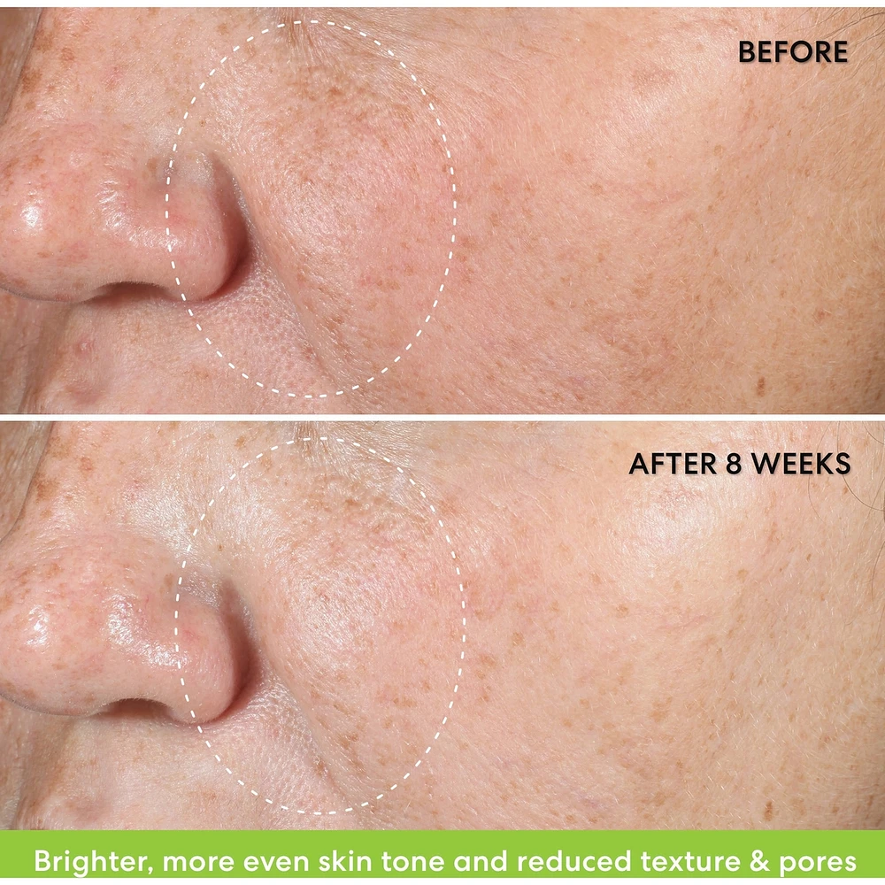 Ageless 10% Phyto-Retinol Night Concentrate 30ML