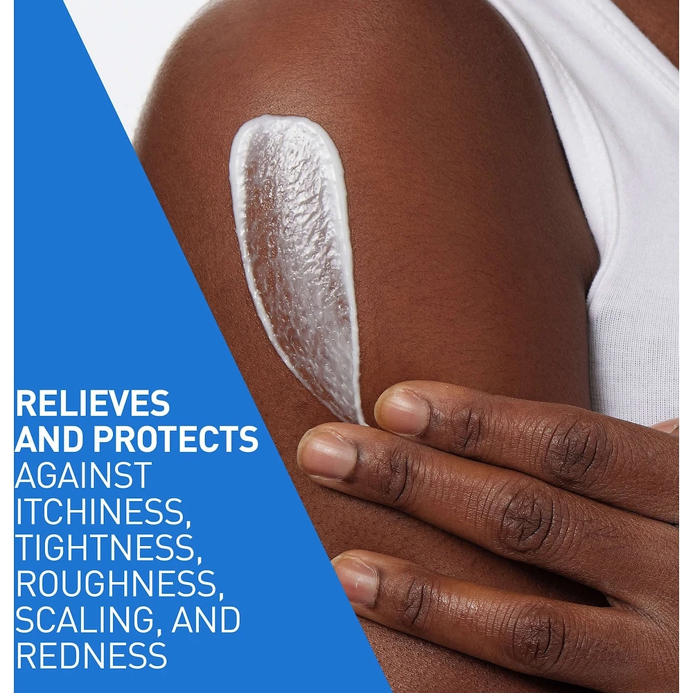 Intensive Moisturizing Lotion 5% HYDRO-UREA TM/MC