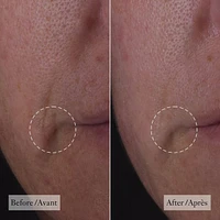 dose of wisdom™ sérum réactivant pour une peau rebondie hydratée et soutenue grace au collagène, enrichi en oxygène, vitamine C acide hyaluronique