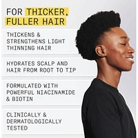 Nioxin System 1 Scalp  + Hair Thickening Treatment - Serum for Natural Hair with Light Thinning, 100ml
