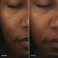 Sérum Lissant Enrichi en Vitamines