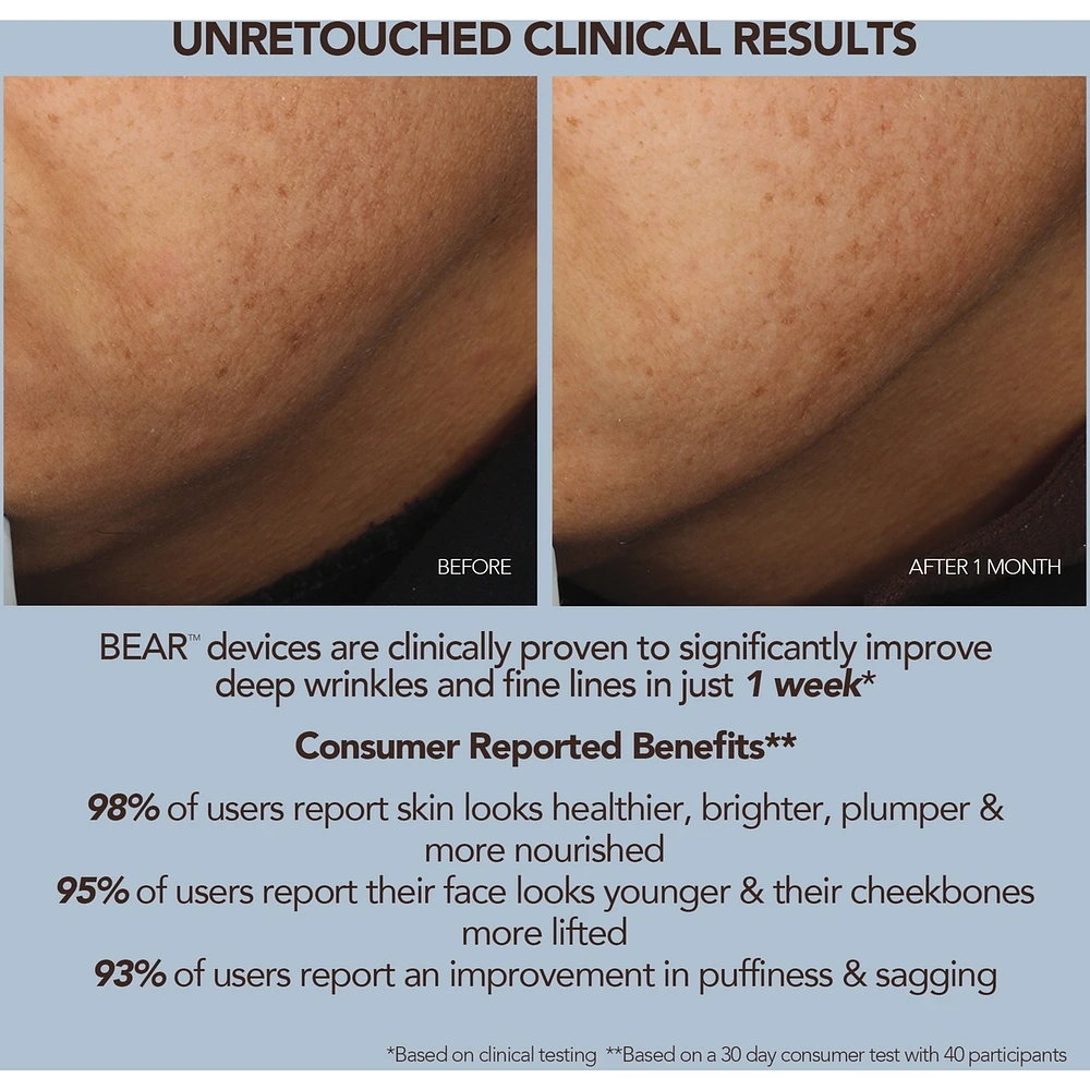 BEAR 2 Fuchsia Advanced Microcurrent Facial Toning Device