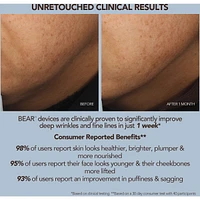 BEAR 2 Fuchsia Advanced Microcurrent Facial Toning Device