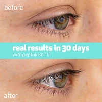 peptalash™ II - sérum intensifiant pour les cils