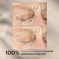 Intensive Eye Concentrate For Wrinkles Plus