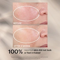 Advanced Retinol Nightly Renewal Moisturizer