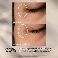 Super-C Dark Circle Brightening Eye Serum