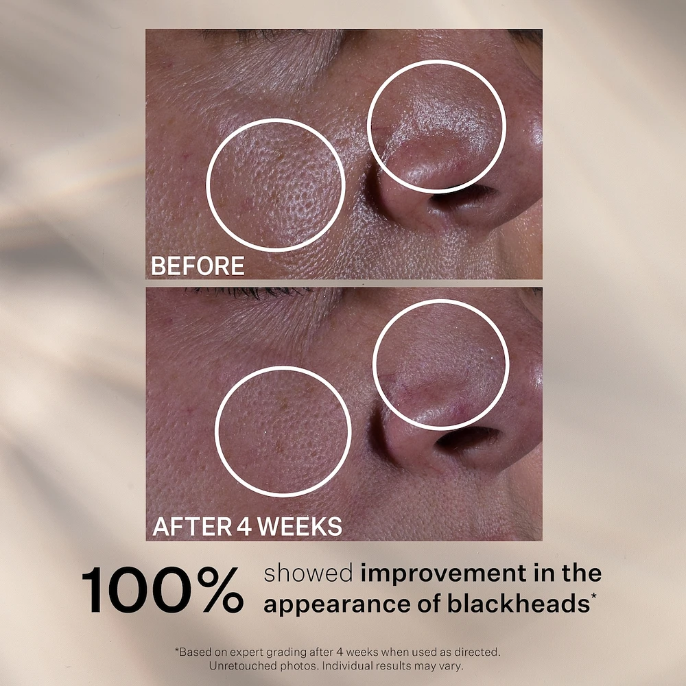 Multi-Action Super Shrink Pore Minimizing Serum