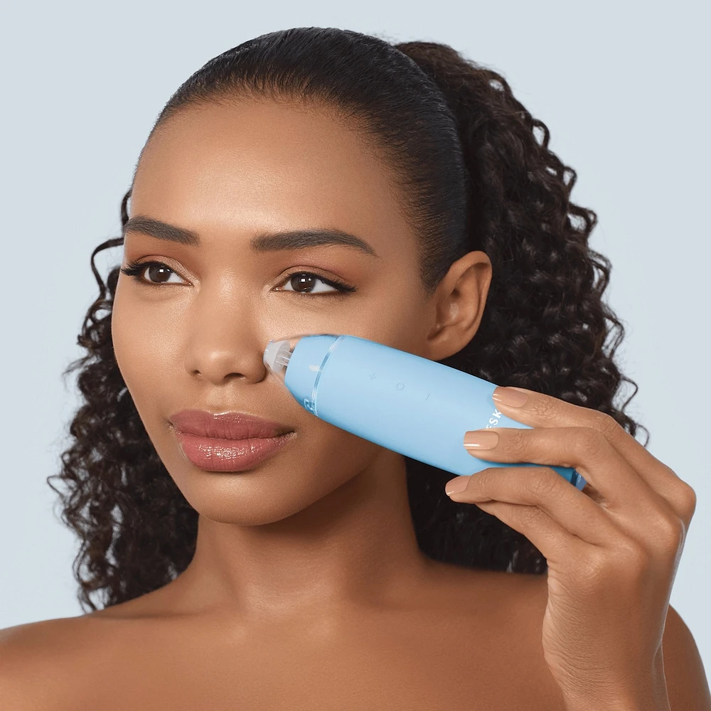 Microdermabrasion Blackhead Remover (Black)