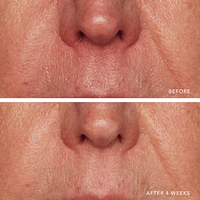 Redness Relief Intense with Manuka Honey