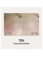 Skincare Serum and Cream Starter Kit