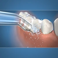 Embout WaterpikMD Pik PocketMC Tip