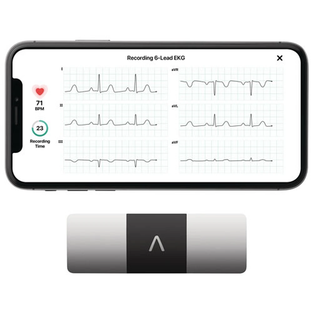 KardiaMobile 6L Portable EKG Monitor (AC-019-NUA-A)