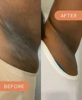 Forgotten Skincare The Original Underarm Brightening Deodorant Cream