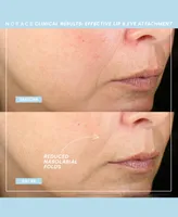 NuFACE Effective Lip & Eye Attachment
