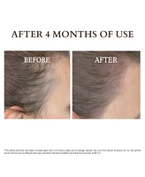 Solaris Laboratories Ny Led Light Therapy Anti Hair Loss Treatment Combo Kit, 2 Piece