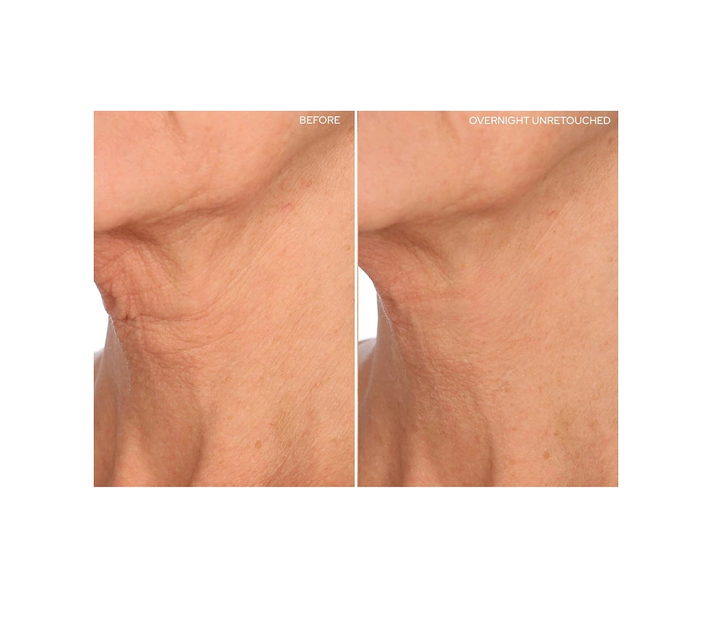 SiO Beauty FaceLift