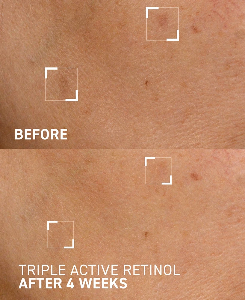 Dr. Brandt Triple Active Retinol Gentle Overnight Renewal Cream, 1 oz.