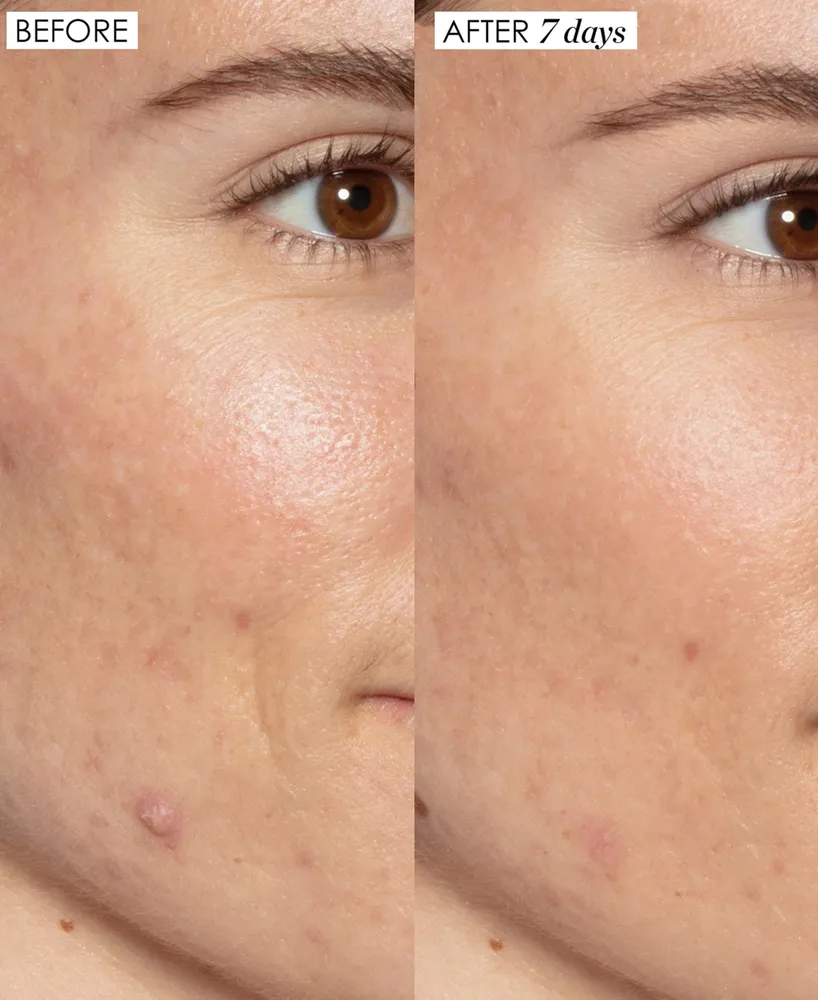 Sunday Riley Good Genes All-In-One Lactic Acid Treatment