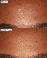 Sunday Riley Good Genes All-In-One Lactic Acid Treatment