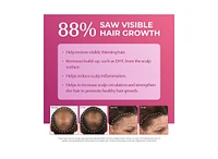 BosleyMD Womens Hair Re-growth Treatment 2% Minoxidil Dropper
