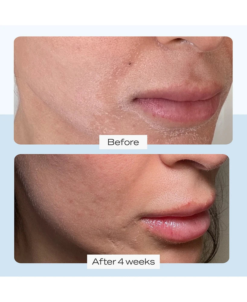 First Aid Beauty Ultra Repair Cream, 6-oz.