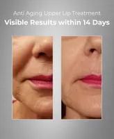 Bionova Upper Lip Treatment With Uv Chromophores