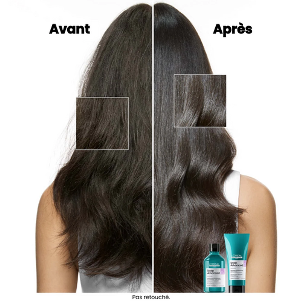 Scalp Advanced